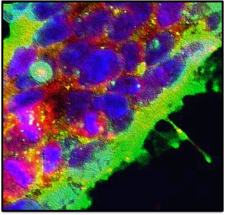 Human stem cells expressing the HERV-K envelope protein. Credit: David Wang