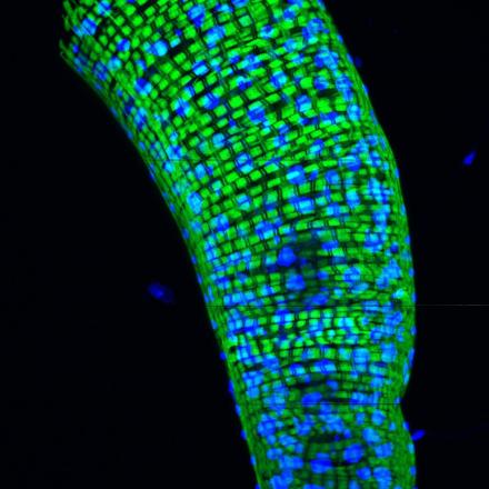 Drosophila midgut, labelled to visualize nuclei (blue - DAPI) and actin (green - Phalloidin). Credit: Arvind Shukla/Edward Giniger