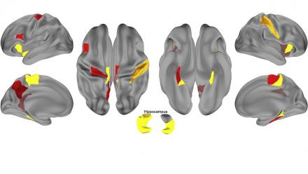Modified from Figure 3 of the publication, a visual representation of brain regions supporting replay events, identified through principal component analysis.