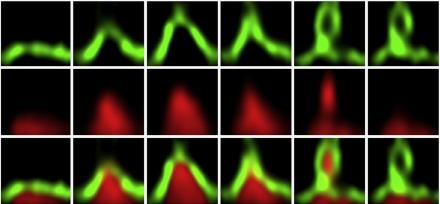 Fluorescent STED images showing novel observation of transitions in membrane shape from flat surface to pinched-off vesicle. 