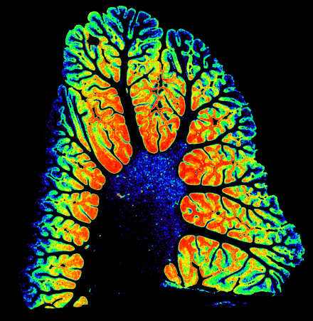 “Arbor Vitae,” colorized image from formalin fixed human cerebellum acquired at 100 micron isotropic resolution on the 11.7T MRI system. Image credit: Govind Nair Bhagavatheeshwaran), Staff Scientist in the qMRI Core Facility, and Stephen Dodd, Staff Scientist, at the Laboratory of Functional and Molecular Imaging.