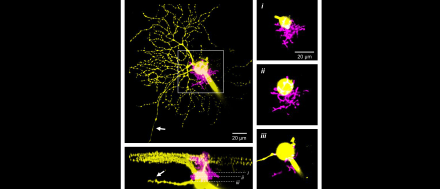 Image Credit: Dr. William Grimes. Description: Dendro-somatic synaptic contact between an inhibitory interneuron (magenta) and a retinal ganglion cell (yellow). These synaptic contacts, described in Grimes et al., 2021, convey high-sensitivity visual signals under low light conditions. In the dark, a sustained OFFα ganglion cell transmits a steady train of action potentials down its axon (white arrow). Dim light stimuli activate the interneuron, which inhibits the OFFα soma and interrupts spiking.