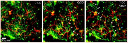 Time lapse microscope images show microglia (green) interacting with blood vessels (red) 30 minutes and 1 hour after CVI
