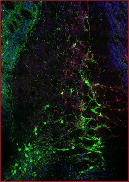 The image shows BFCNs in green. Red cells represent neurons that were activated during the recall of a fear memory. Activated BFCNs can be seen as yellow neurons. The Blue stain represents Nissl, which delineates neurons.