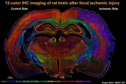 The image shows complex tissue remodeling in the coronal section of a rat brain following focal ischemic brain injury