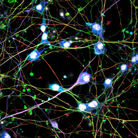 Image of iPSC-derived Sensory Neurons. Credit: Alec Nickolls