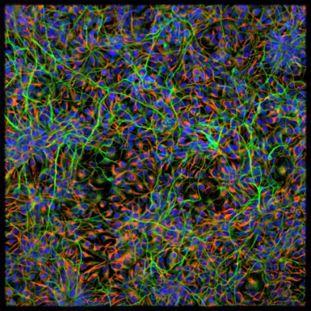 Human neurons derived from NSCs by Jack Marshall (PI: Avindra Nath @nathavindra)