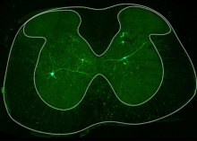 Virally-labeled spinocerebellar neurons in the lumbar spinal cord