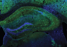 Interneurons (green) in the hippocampus of a mouse. These cells play a subtle but powerful role in balancing neural activity during the sleep-wake cycle. Lu lab, NIH/NINDS