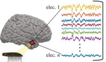 A microelectrode array (bottom left) was placed on the human temporal cortex to record neural responses to different image types and explore whether the responses were organized into clusters. 